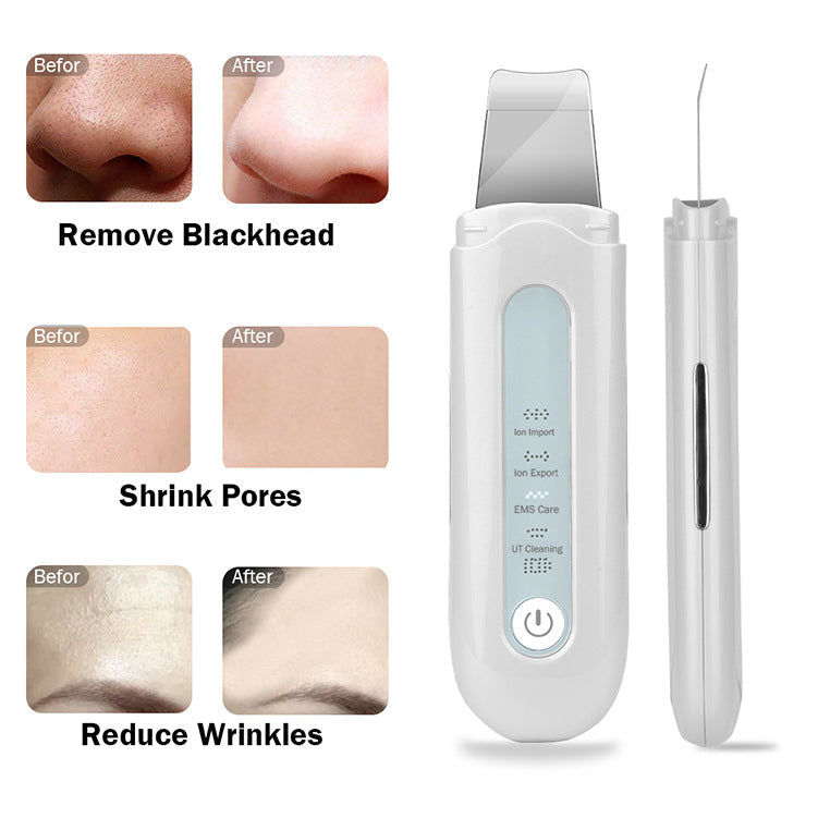 HexoSkin™ Ultrasone dieptereiniger voor de huid