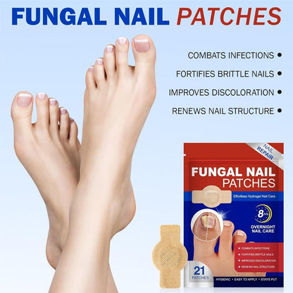 HexoNail™ Hydrogel nagelpleisters voor verkleurde en beschadigde nagels – 21 stuks