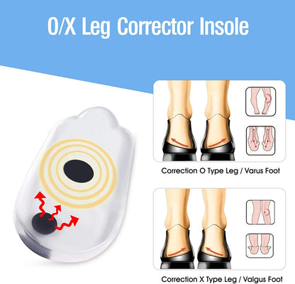 HexoAlign™ Magnetische Gel-inlegzolen voor Pijnverlichting, Houdingscorrectie en Voetondersteuning