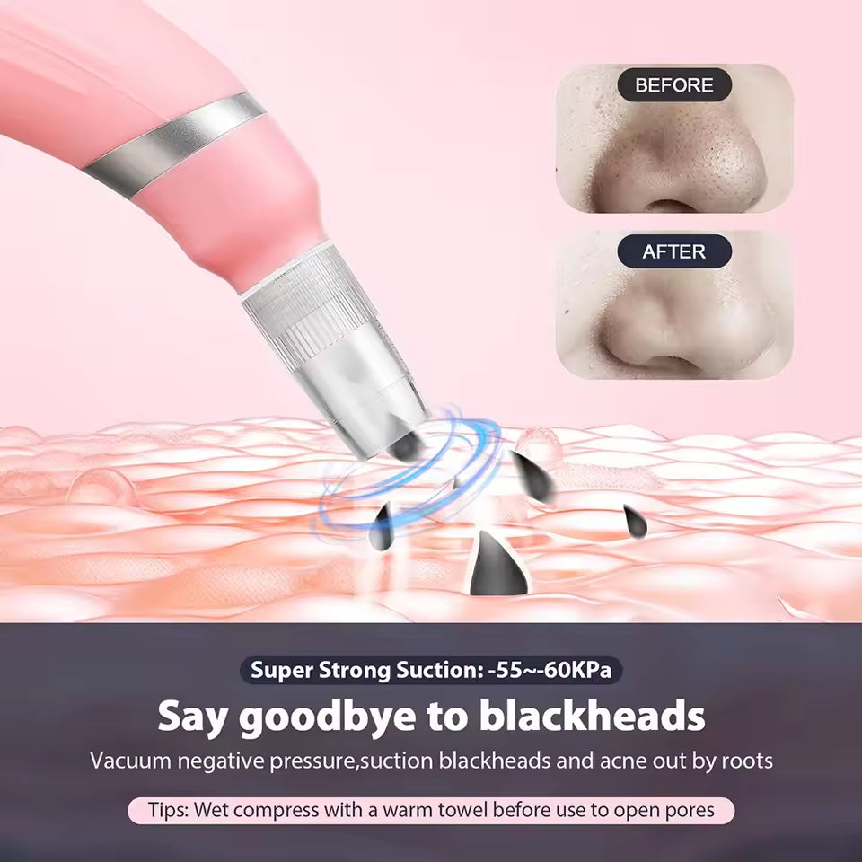 HexoGlow™ Microdermabrasie Poriënreiniger Voor Stralende Huid 4