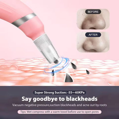 HexoGlow™ Microdermabrasie Poriënreiniger Voor Stralende Huid 4