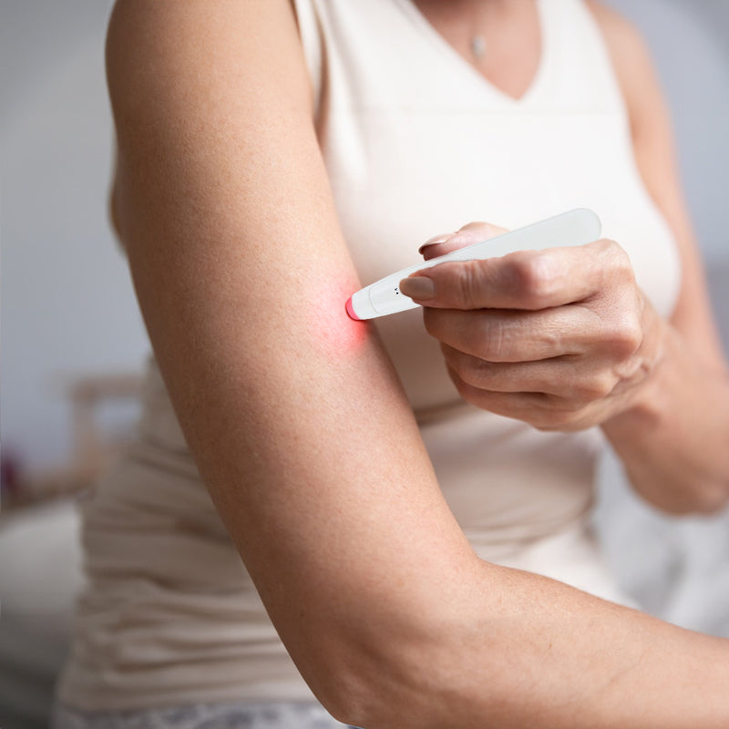 HexoBite™ – oplaadbare jeukstift tegen muggenbeten, zonder chemicaliën en geschikt voor alle leeftijden