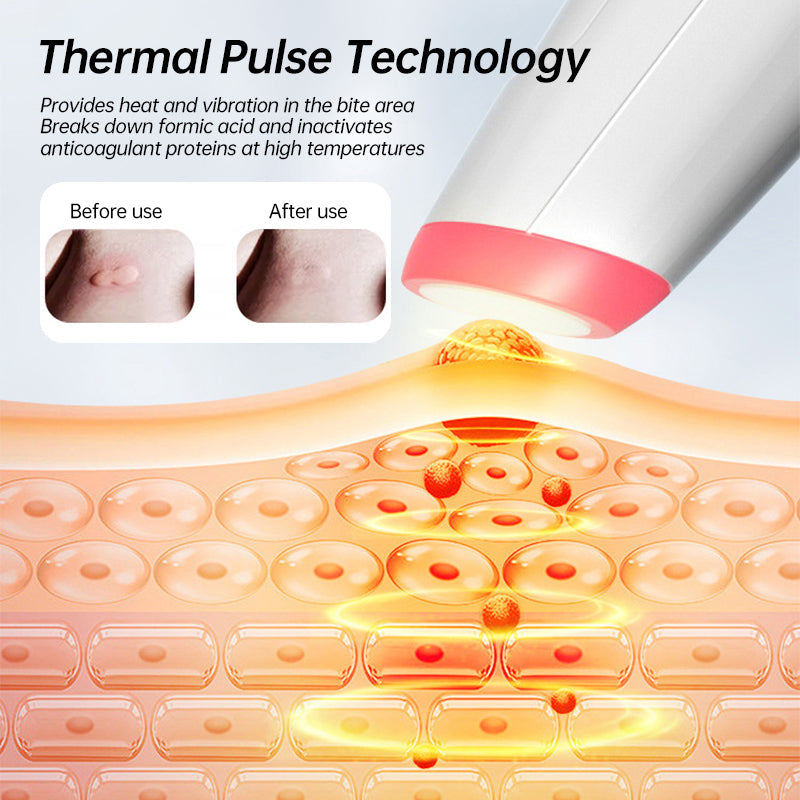 HexoBite™ – oplaadbare jeukstift tegen muggenbeten, zonder chemicaliën en geschikt voor alle leeftijden
