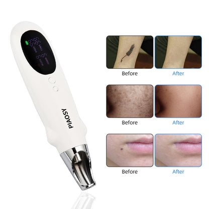 PIAOSY™ Picosecond Pen voor Acne Littekens en Tattoo Verwijderen 2