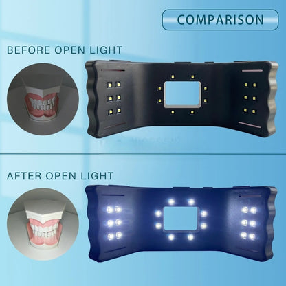 HexoSmile™ – LED Tandheelkundige Vullicht voor Precieze Mondfotografie