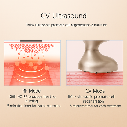 HexoTone™ Ultrasonic EMS & RF Massager Voor Lichaamsversteviging en Huidverjonging