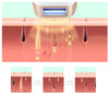 HexoSkin™ IPL-Laserontharingsapparaat