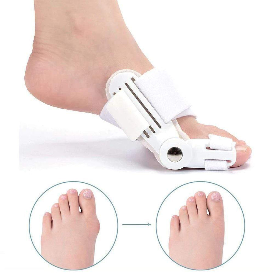 HexoBunion™ Corrigerende Spalk voor Bunions (1 Paar)
